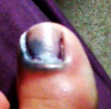 i promise this post about my tooth is not as gross as the blogs about my toe when it died.